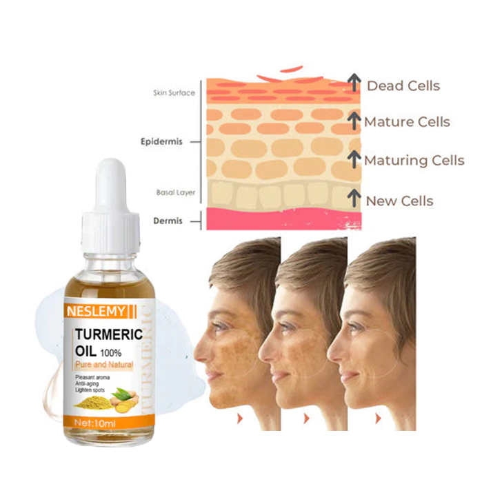(🔥LAST DAY SALE-80% OFF)-Fast Dark Spot Remover-NESLEMY™ Turmeric Spot Repair Serum