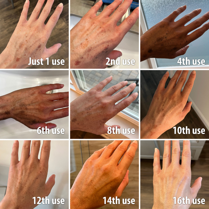 (🔥LAST DAY SALE-80% OFF)-Fast Dark Spot Remover-NESLEMY™ Turmeric Spot Repair Serum