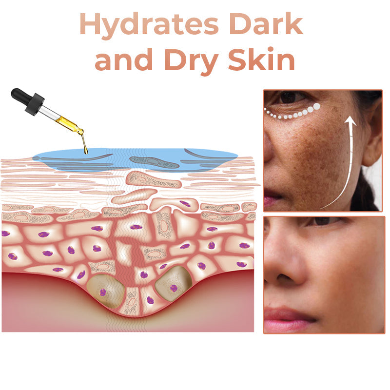 (🔥LAST DAY SALE-80% OFF)-Fast Dark Spot Remover-NESLEMY™ Turmeric Spot Repair Serum