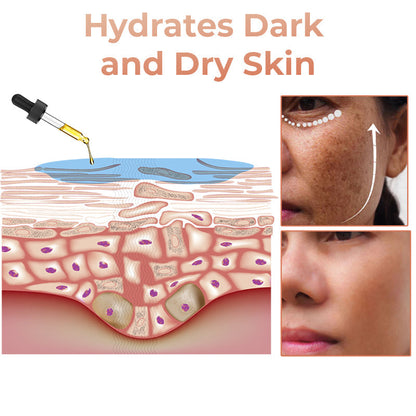 (🔥LAST DAY SALE-80% OFF)-Fast Dark Spot Remover-NESLEMY™  Turmeric Spot Repair Serum